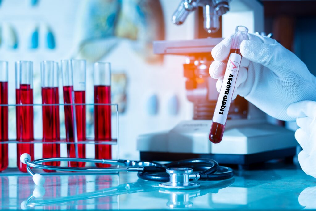 Liquid biopsy - multi cancer detection